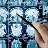 neurochirurgia neurochirurgia