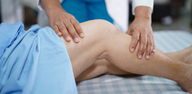 artrosi al ginocchio